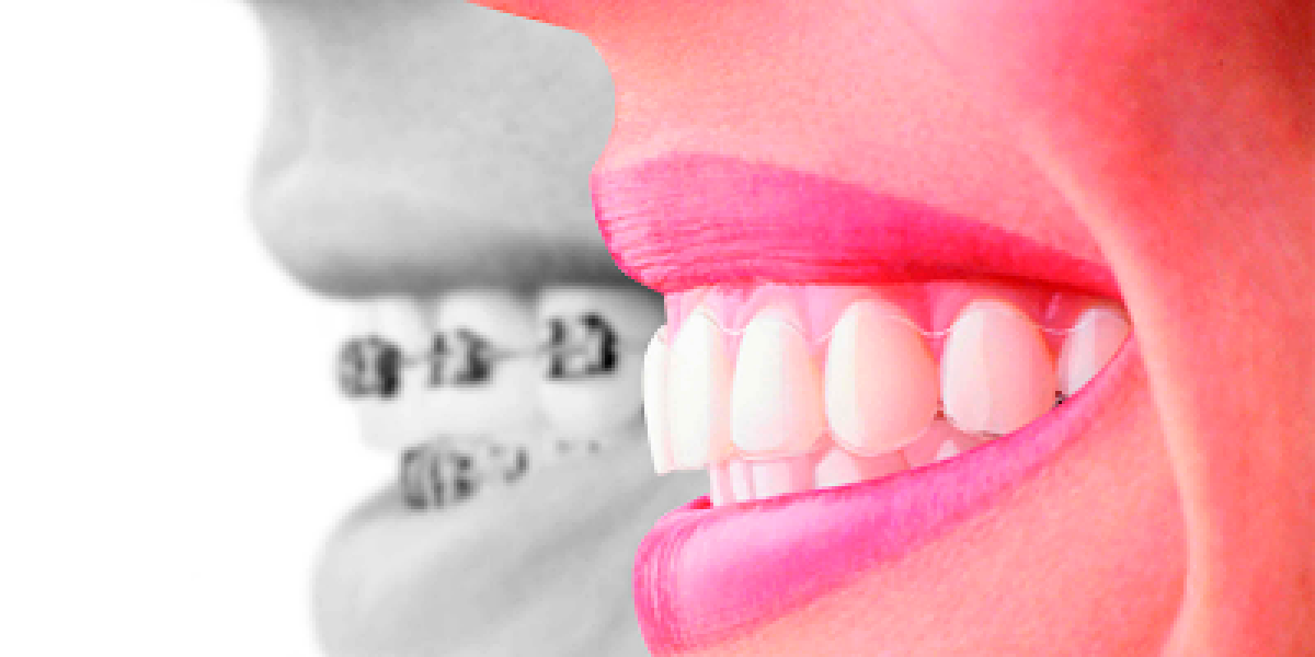 estetica-dental